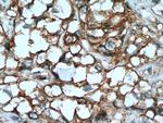 AHNAK2 Antibody in Immunohistochemistry (Paraffin) (IHC (P))