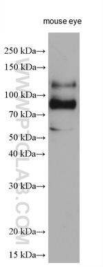 VEZT Antibody in Western Blot (WB)