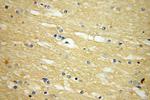 VEZT Antibody in Immunohistochemistry (Paraffin) (IHC (P))