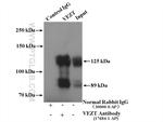 VEZT Antibody in Immunoprecipitation (IP)