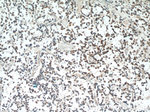 ABL2 Antibody in Immunohistochemistry (Paraffin) (IHC (P))