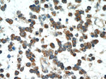 ABL2 Antibody in Immunohistochemistry (Paraffin) (IHC (P))