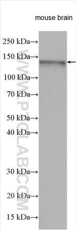 ABL2 Antibody in Western Blot (WB)