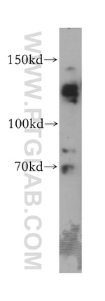 ABL2 Antibody in Western Blot (WB)