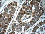 ABL2 Antibody in Immunohistochemistry (Paraffin) (IHC (P))