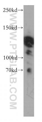 ABL2 Antibody in Western Blot (WB)