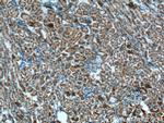 OCRL Antibody in Immunohistochemistry (Paraffin) (IHC (P))