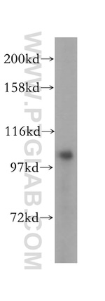 OCRL Antibody in Western Blot (WB)