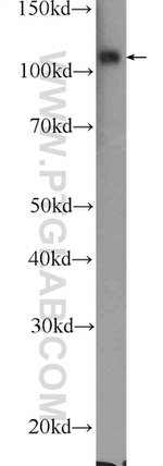 OCRL Antibody in Western Blot (WB)