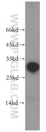 NRIP2 Antibody in Western Blot (WB)