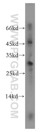 NRIP2 Antibody in Western Blot (WB)