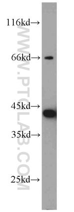 ARL13B Antibody in Western Blot (WB)