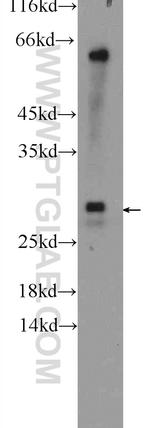 UBE2J2 Antibody in Western Blot (WB)