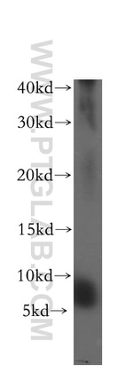 USMG5 Antibody in Western Blot (WB)