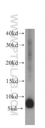 USMG5 Antibody in Western Blot (WB)