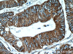 EB1 Antibody in Immunohistochemistry (Paraffin) (IHC (P))