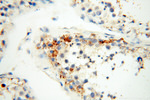 EB1 Antibody in Immunohistochemistry (Paraffin) (IHC (P))