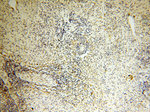 EB1 Antibody in Immunohistochemistry (Paraffin) (IHC (P))