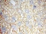 EB1 Antibody in Immunohistochemistry (Paraffin) (IHC (P))