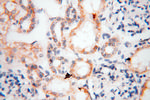 EB1 Antibody in Immunohistochemistry (Paraffin) (IHC (P))