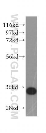 EB1 Antibody in Western Blot (WB)