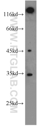 EB1 Antibody in Western Blot (WB)