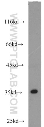 EB1 Antibody in Western Blot (WB)