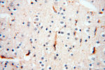 CSK Antibody in Immunohistochemistry (Paraffin) (IHC (P))