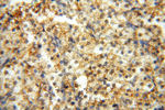 CSK Antibody in Immunohistochemistry (Paraffin) (IHC (P))