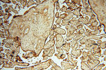 CSK Antibody in Immunohistochemistry (Paraffin) (IHC (P))