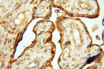 CSK Antibody in Immunohistochemistry (Paraffin) (IHC (P))