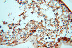 CSK Antibody in Immunohistochemistry (Paraffin) (IHC (P))