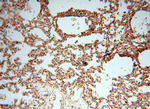 CSK Antibody in Immunohistochemistry (Paraffin) (IHC (P))