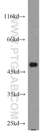 CSK Antibody in Western Blot (WB)