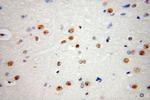 DHX9 Antibody in Immunohistochemistry (Paraffin) (IHC (P))