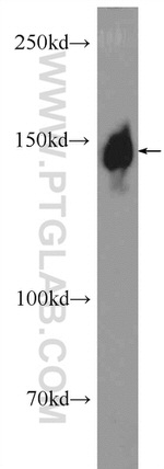 DHX9 Antibody in Western Blot (WB)