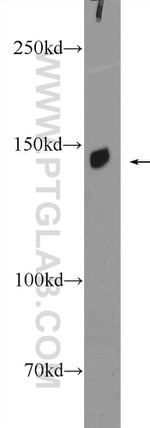 DHX9 Antibody in Western Blot (WB)