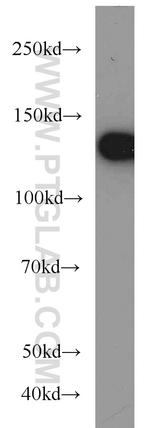 DHX9 Antibody in Western Blot (WB)