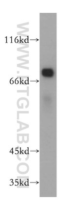 SAMD4B Antibody in Western Blot (WB)