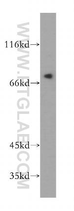 SAMD4B Antibody in Western Blot (WB)