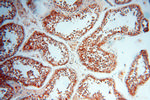 ATP6V1F Antibody in Immunohistochemistry (Paraffin) (IHC (P))