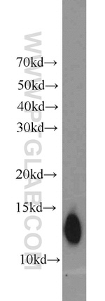 ATP6V1F Antibody in Western Blot (WB)