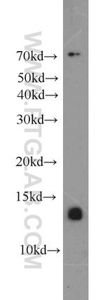 ATP6V1F Antibody in Western Blot (WB)