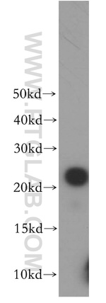 BLVRB Antibody in Western Blot (WB)