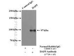 DAP5 Antibody in Immunoprecipitation (IP)