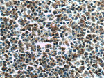 BCL10 Antibody in Immunohistochemistry (Paraffin) (IHC (P))