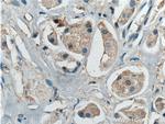 BCL10 Antibody in Immunohistochemistry (Paraffin) (IHC (P))