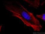 EDC4 Antibody in Immunocytochemistry (ICC/IF)