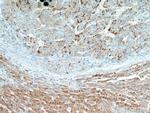 EDC4 Antibody in Immunohistochemistry (Paraffin) (IHC (P))