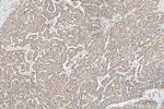 EDC4 Antibody in Immunohistochemistry (Paraffin) (IHC (P))